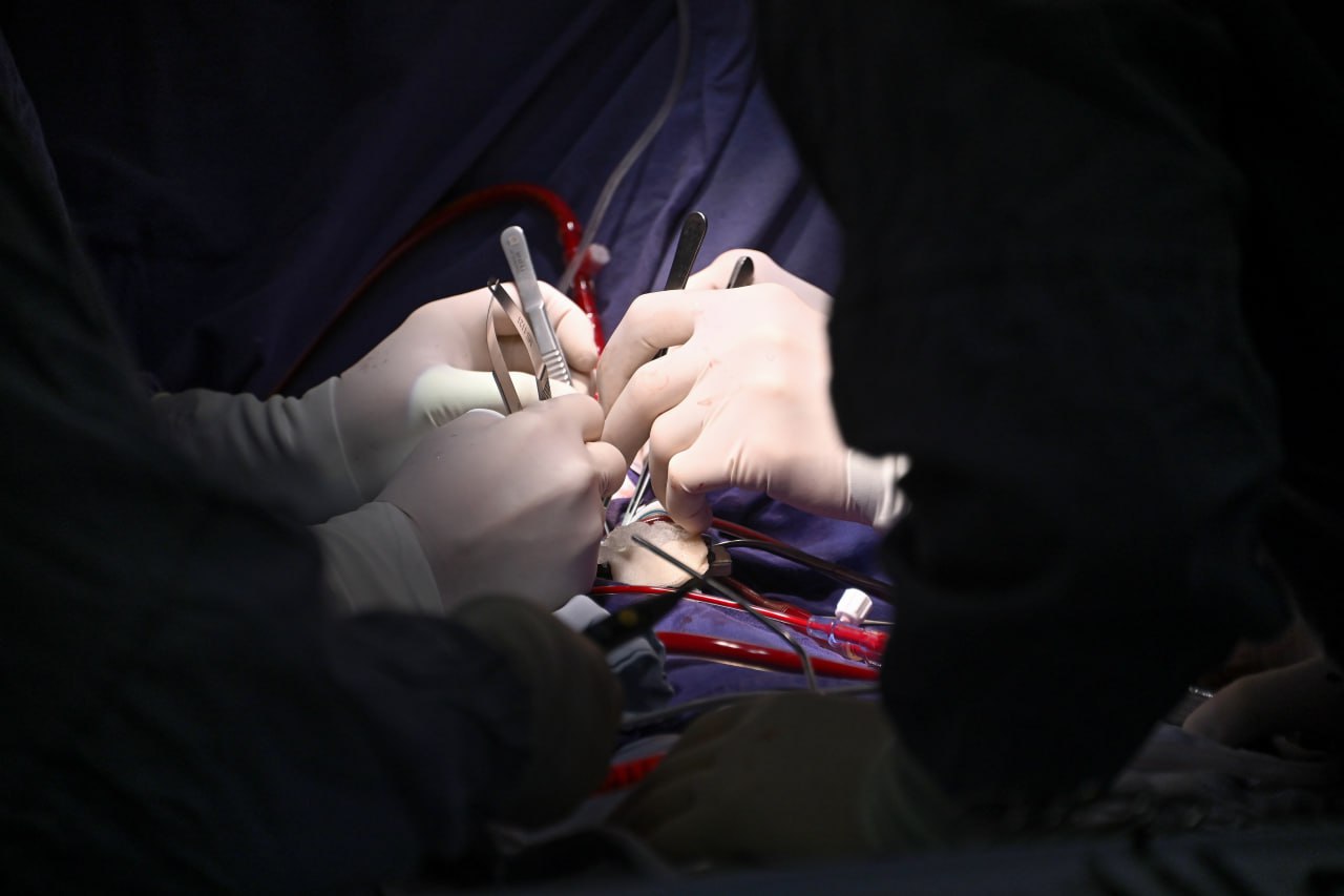 Впервые на Дальнем Востоке: якутские врачи провели селективную плазмосорбцию билирубина