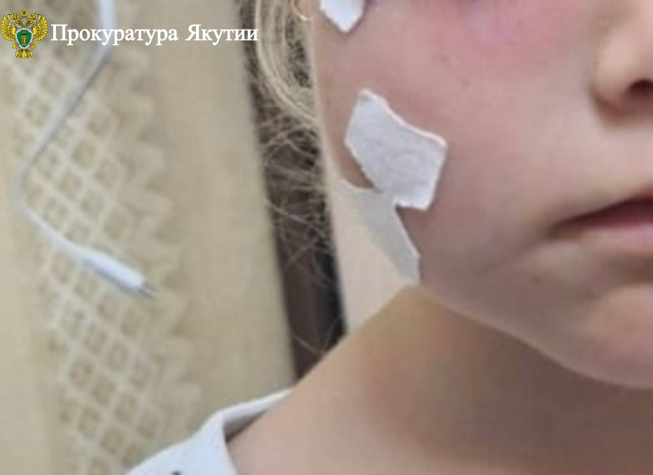 В г. Нерюнгри по иску прокуратуры в пользу ребенка взыскана компенсация морального вреда