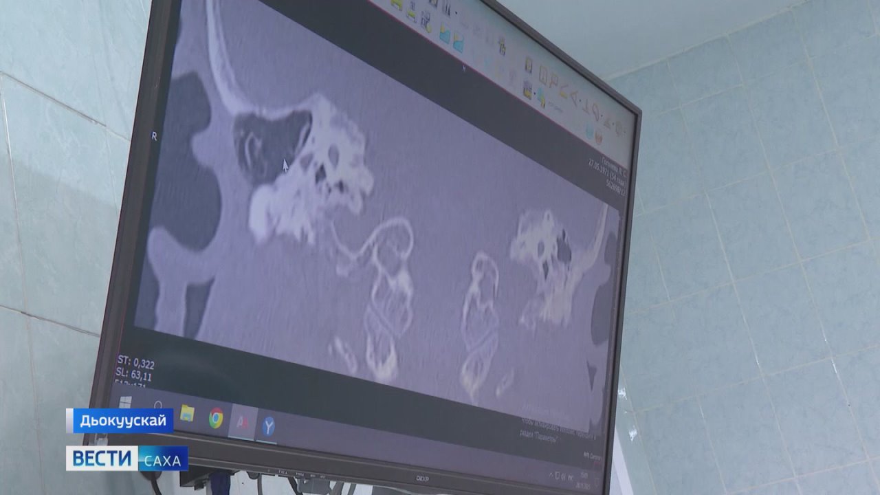 рспблкэтээи 2 №дээх балыыаа Лор салаатыгар саа аппараатынан эпэрээссийэ оордулар