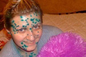 Детские болезни: почему взрослые не защищены от рисков