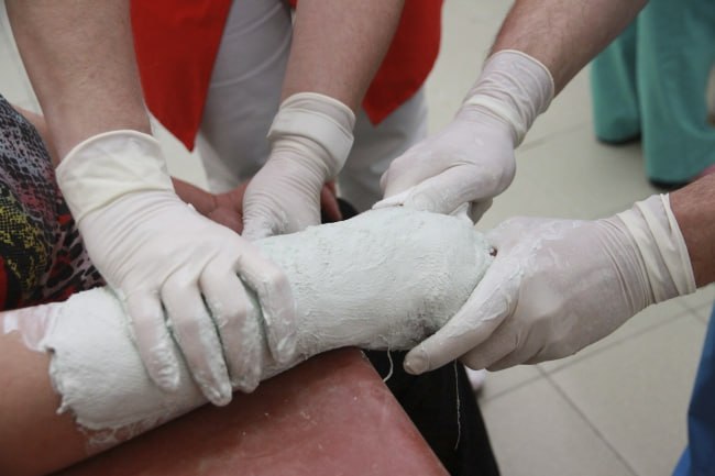 Сломал руку женщине, которая снимала его на телефон