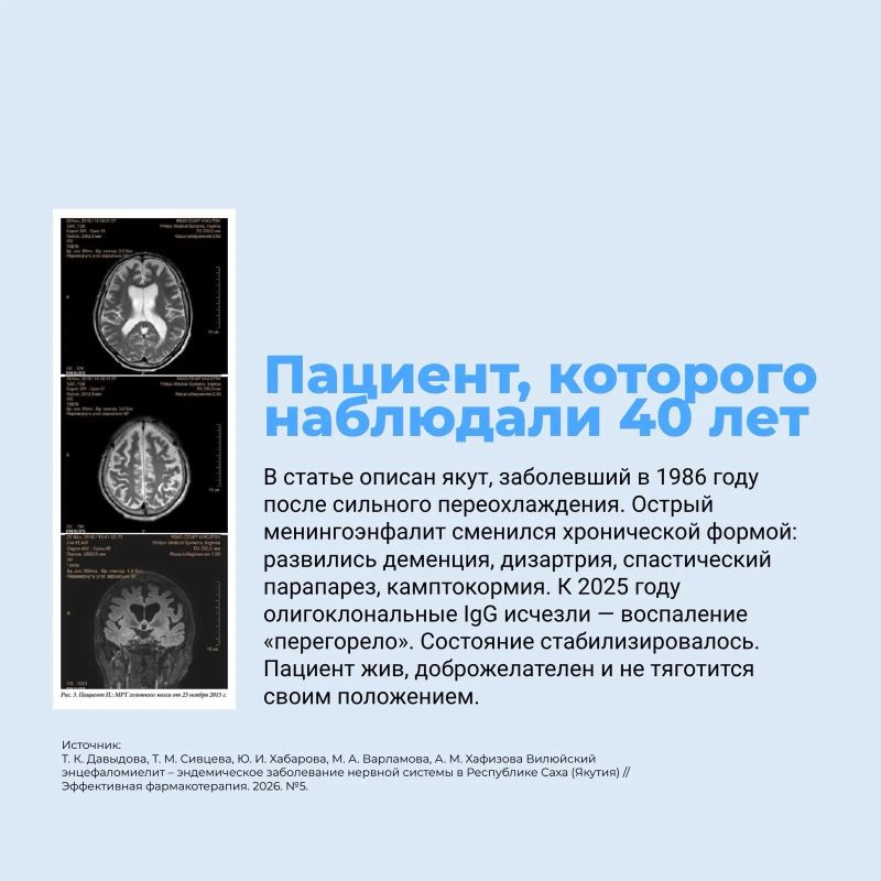 Десятилетие науки и технологий в РФ: обзор научных статей исследователей Якутии Десятилетие науки и технологий в РФ: обзор научных статей исследователей Якутии